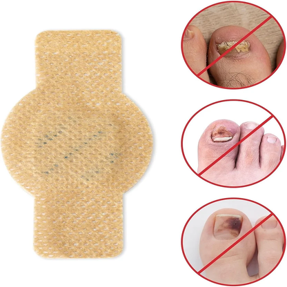 Nailora™ Overnight Nail Patches – Nail Repair & Care